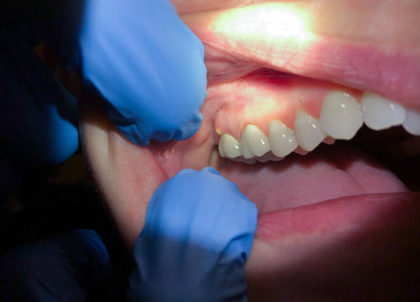 Best After-Hours Dental Care in Pine Knot, KY